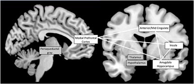 Ictal and Interictal Cardiac Manifestations in Epilepsy. A Review of Their Relation With an Altered Central Control of Autonomic Functions and With the Risk of SUDEP